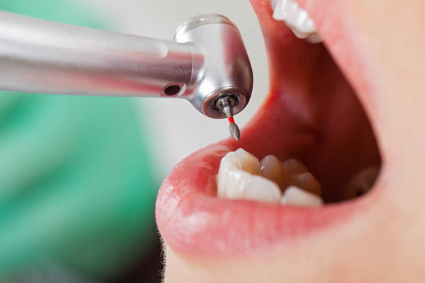Best Emergency Treatment for Oral Infections in Ulysses, KS